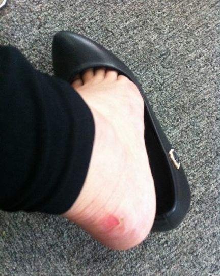 鞋子磨脚后跟怎么处理就不磨脚了,新鞋磨脚怎么办只需这几个小窍门