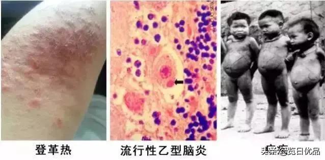 vape驱蚊喷雾驱蚊水 (vape驱蚊水哪个颜色驱蚊效果好)