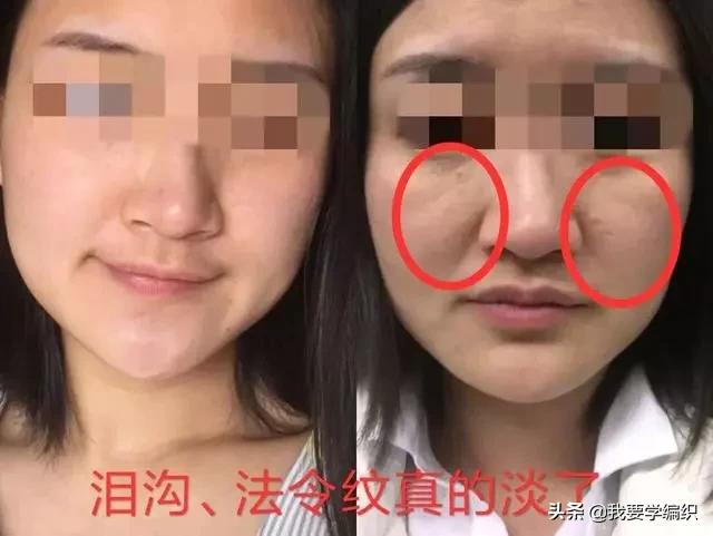 冬天脸干，连皱纹都出来了？日本女博士教你一招，抹几下白白嫩嫩