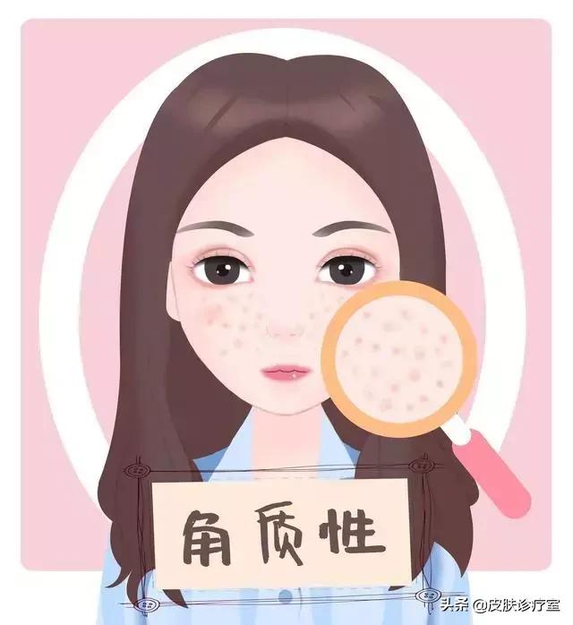 女生毛孔粗大全脸,90岁女人毛孔粗怎么办