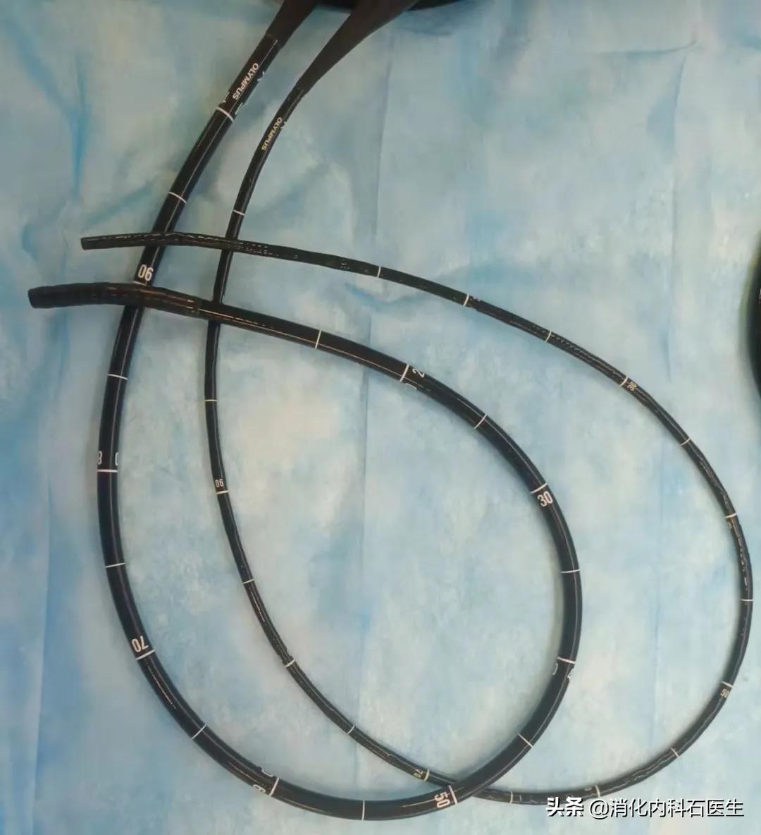 儿童胃痛能吃奥美拉唑吗,小孩胃痛胃胀可以做胃镜吗