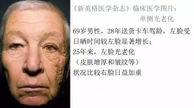 夏天不想晒黑这份防晒攻略请收好,防晒的小tips