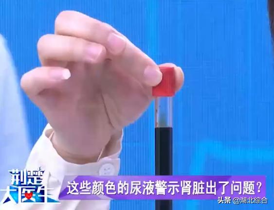 “酱油尿”是咋回事？尿液出现这几种颜色，十有八九是这有毛病