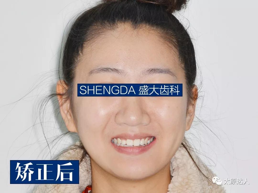 山西“爱马仕”级别齿科医院!get明星同款笑容