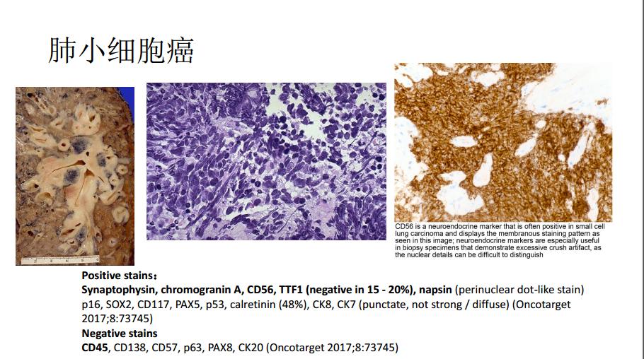 显微镜下的万花世界——走进病理学