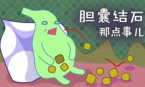 不手术能治疗胆结石吗,不用手术能治疗胆结石吗