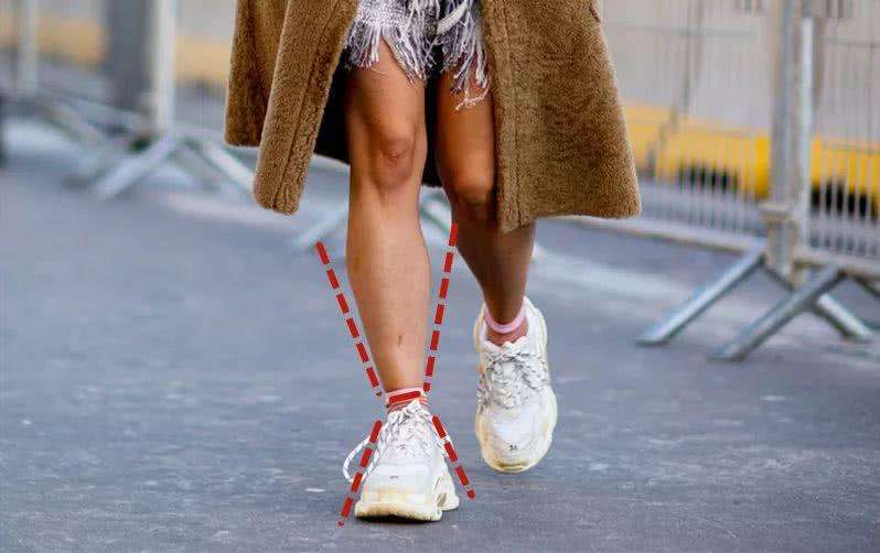 明明很瘦但是腿粗怎么办,天生腿粗可以变成筷子腿吗