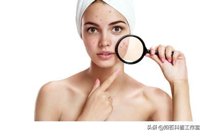 科学挤痘方式,一个视频告诉大家如何正确挤痘痘