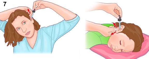 耳朵游泳进水嗡嗡响出不来,耳朵进水后像堵了一层膜听不清