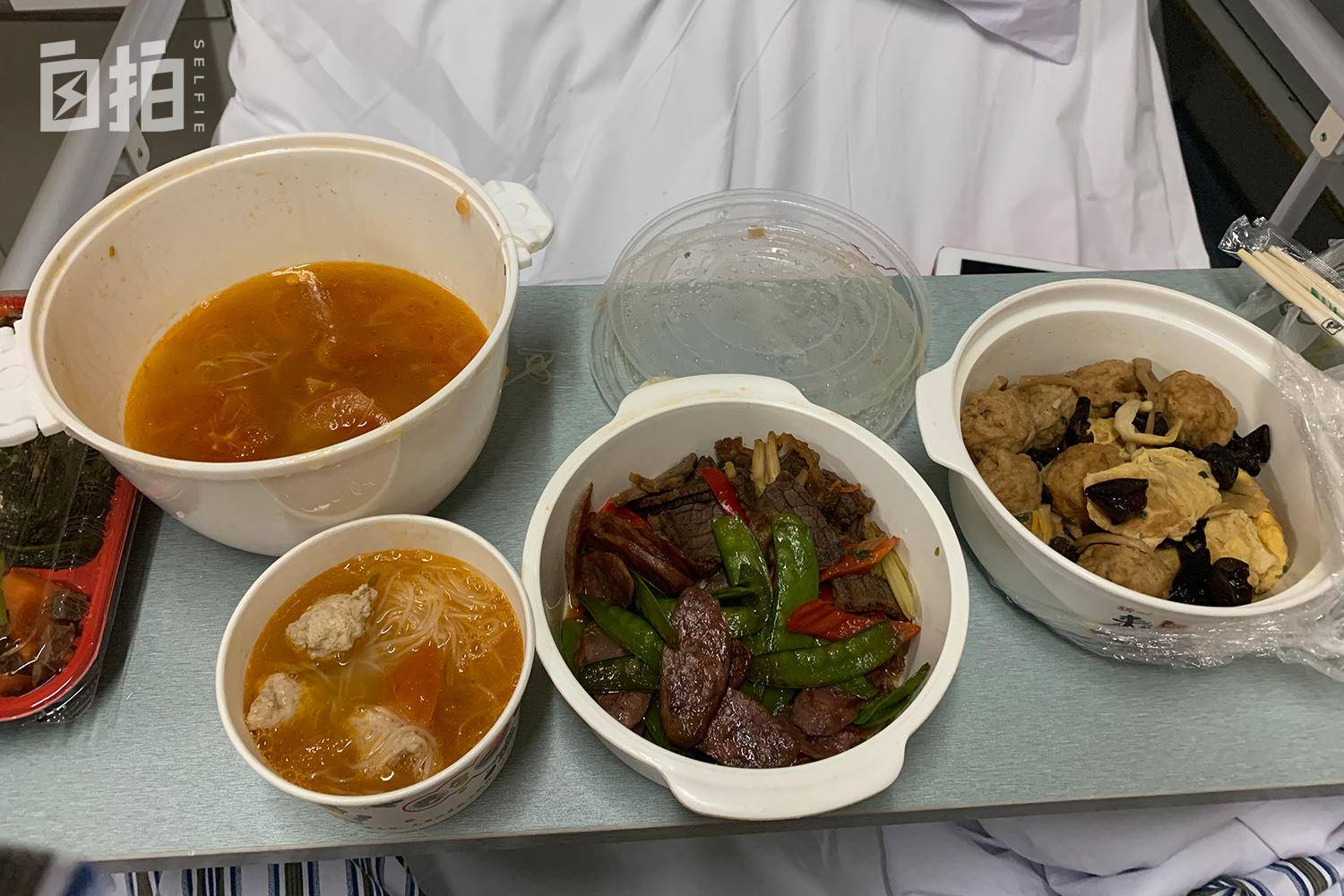 发烧去医院做核酸检测,发烧去医院做了核酸检测