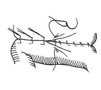 外科8种缝合方法图解,外科基本缝合方法实验报告