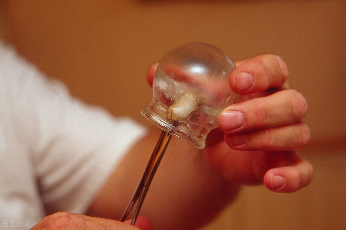 拔罐养生除湿气,中医拔罐的正确方法