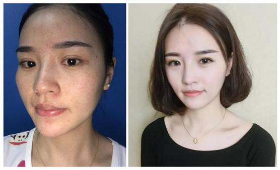 夏天晒黑的皮肤怎样才能快速变白,怎么按摩才能快速变白