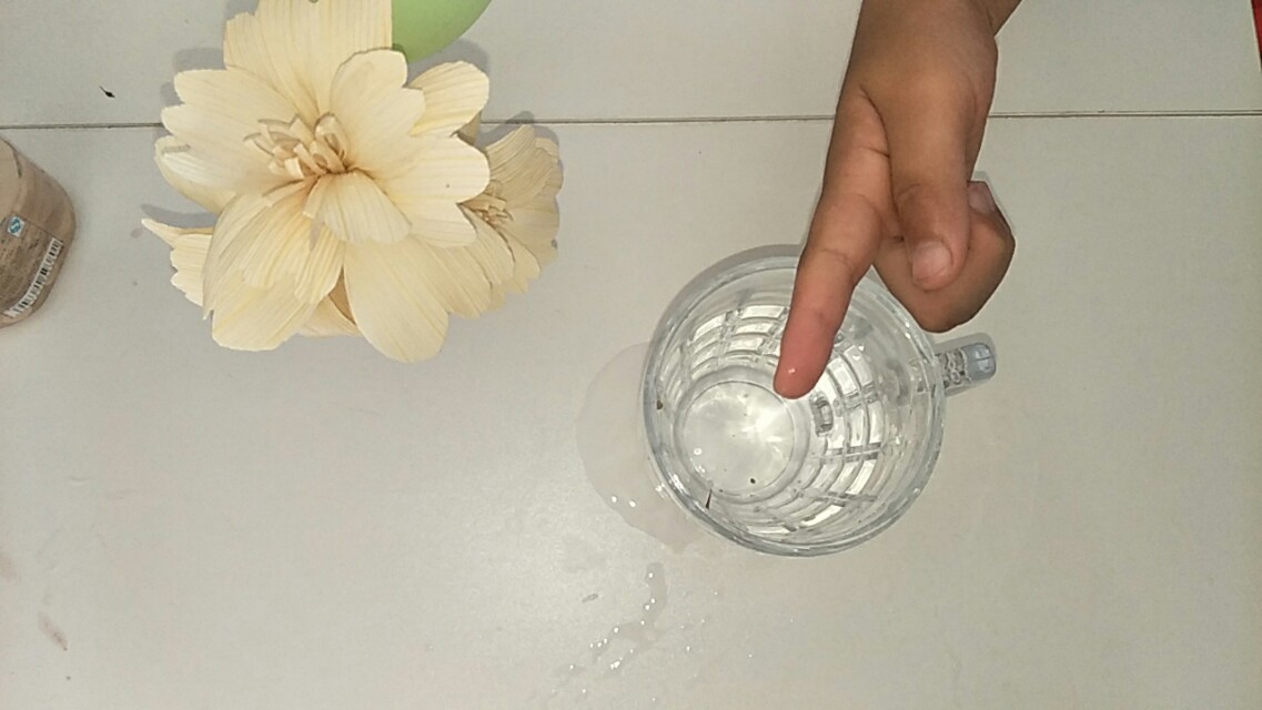 手指头扎刺很深没有刺尾取出妙招,手指头扎刺怎么弄出来不用白醋