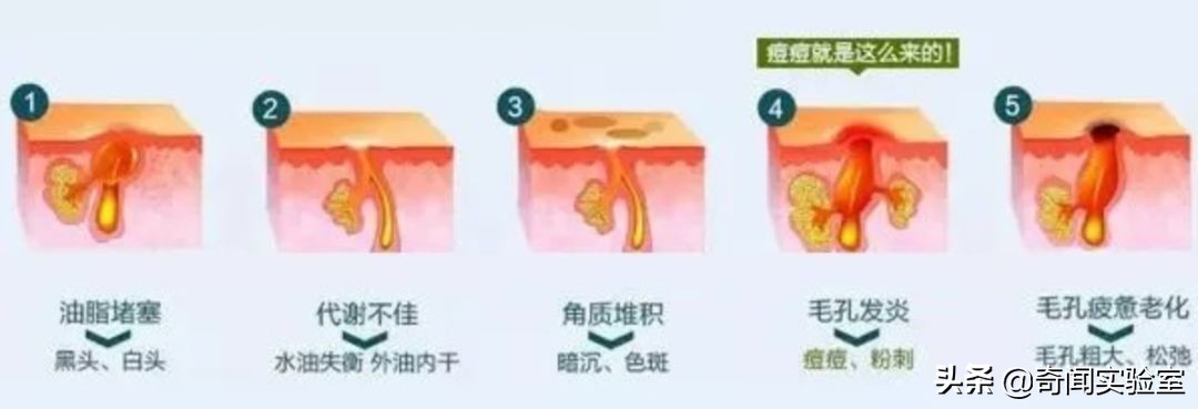 洗澡老是搓不到背怎么办,洗澡自己搓背小妙招