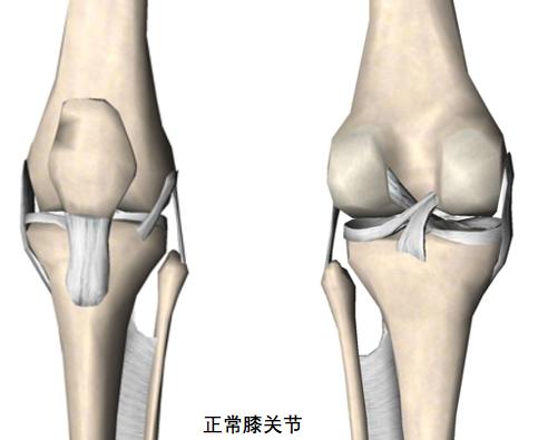 关节弹响是因为软骨磨损吗,关节响是缺钙吗还是骨质疏松