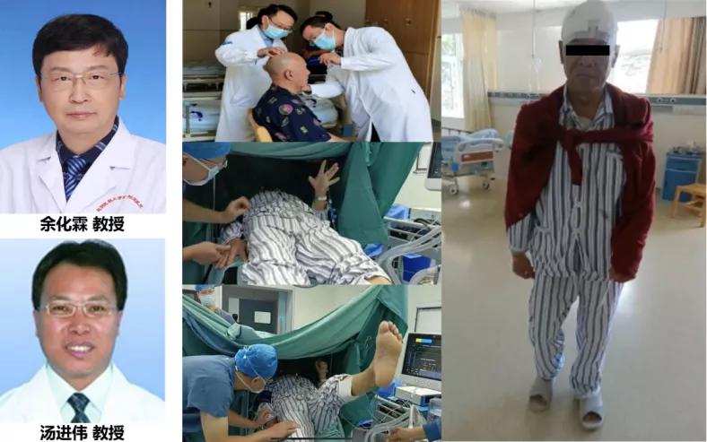 神经调控专业委员会主委余化霖教授团队指导云南省滇南中心医院神经外科完成蒙自市首例脑起搏器治疗帕金森病