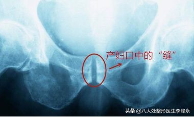 求求宝妈们别再往这个李鬼坑中跳了！