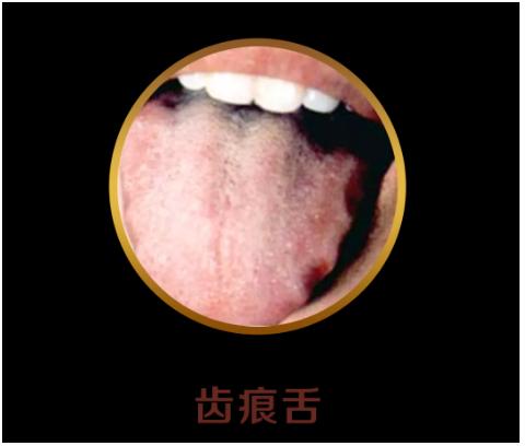 舌头有舌象是什么原因,怎么判断宝宝舌象是否正常