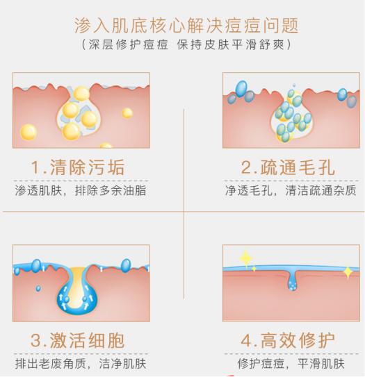 三天痘痘消失,三天不洗脸痘痘没了