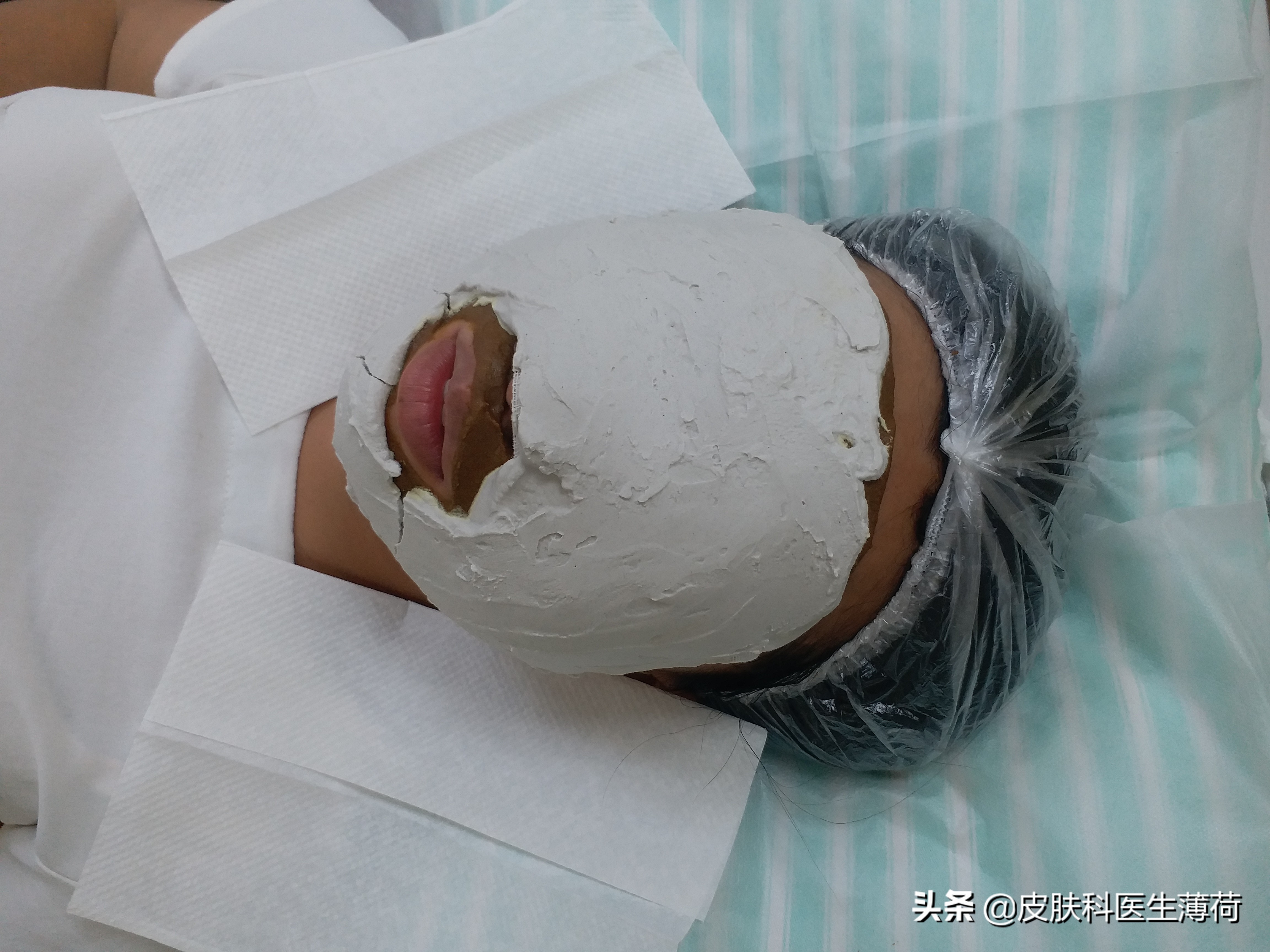 皮肤科医生不留疤痕的秘诀,医生都在用的祛痘方法