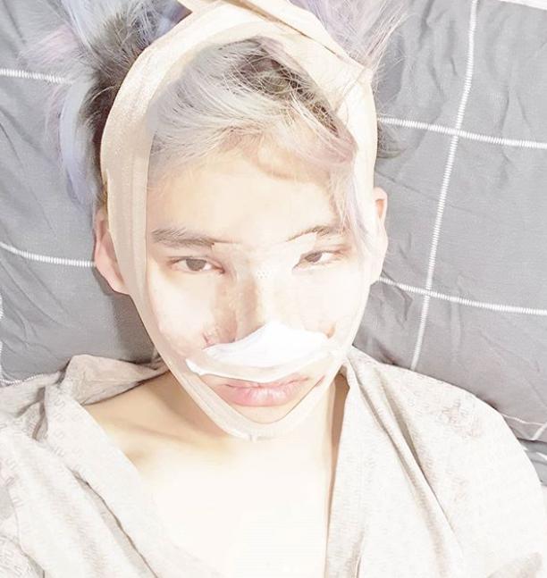 韩国明星男整容对比,韩国男明星整容疑似失败