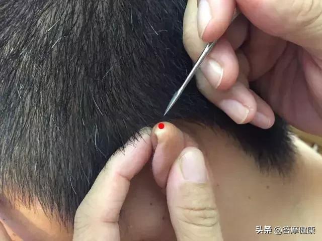 中风急救教学视频教程,急性中风急救视频