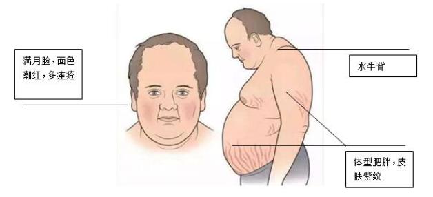 关节封闭针怎么打,关节疼打封闭针视频