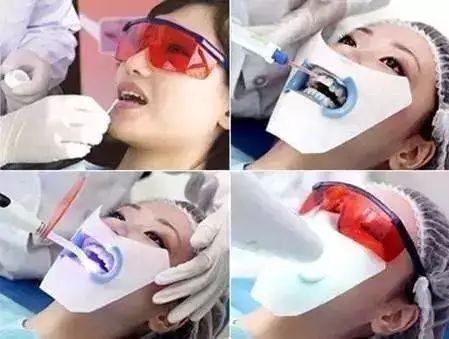 牙齿变色怎么办冷光美白全攻略
