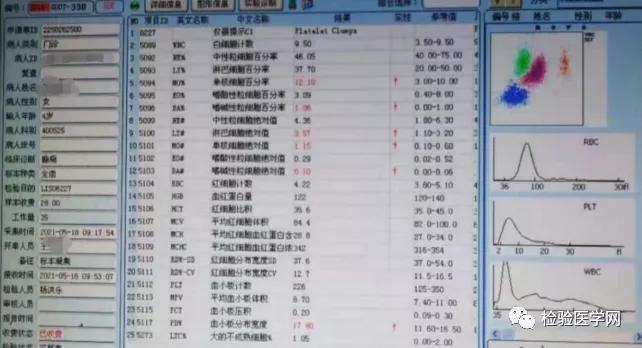 “秒”看血小板聚集，你get到了吗？