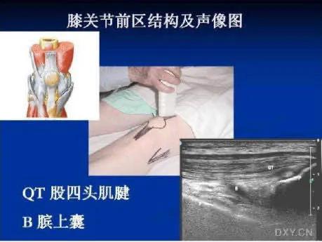 漳浦县医院疼痛科,超声引导下疼痛微创治疗