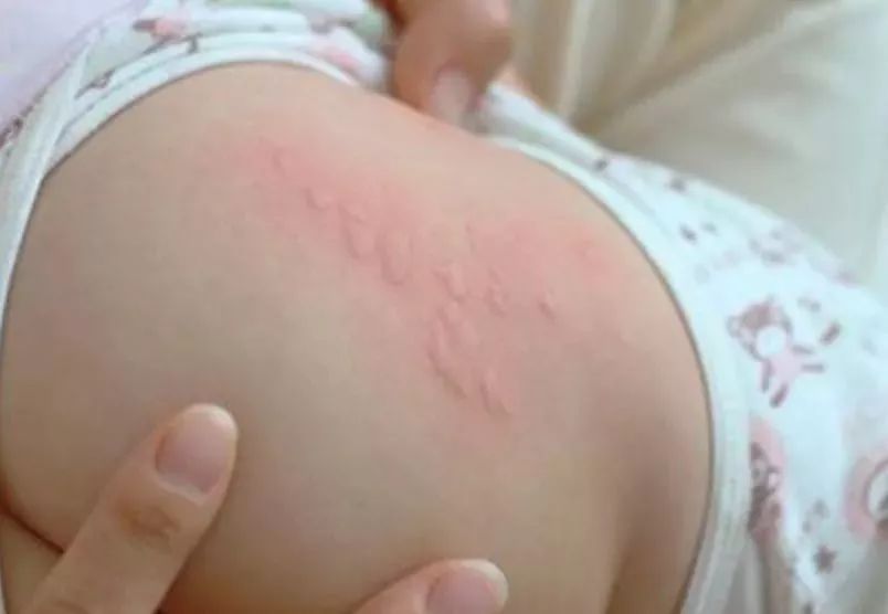 儿童春季常见疾病及治疗,当心这几类传染病近期高发