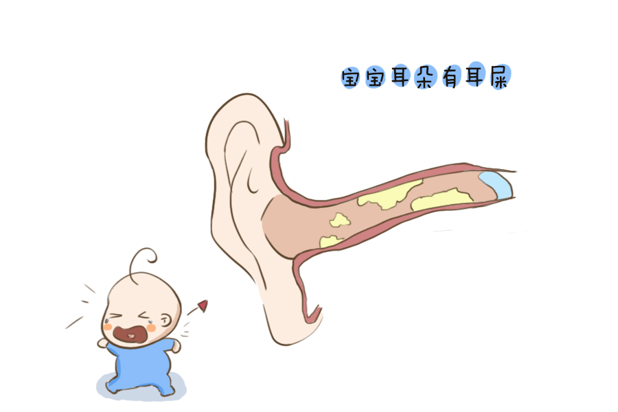 宝宝耳朵里有耳屎不让掏怎么办,宝宝的耳朵有耳屎怎么办