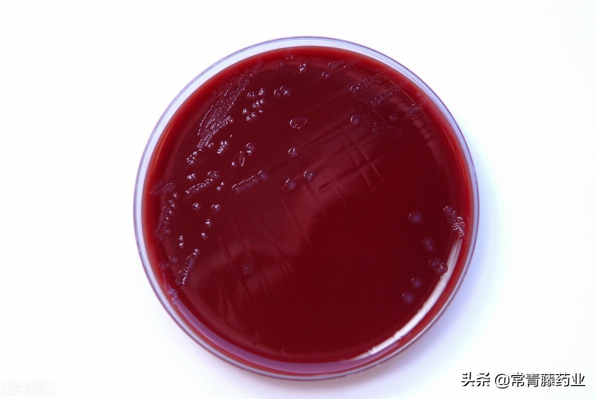 淋病治疗需要注意什么,淋病检查都需要做哪些