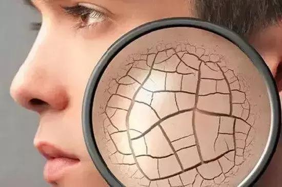 护肤品含铅汞停用后长斑,化妆品导致的铅汞斑能彻底治好吗