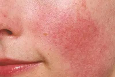 李佳琦没骗人！“国货之光”拯救烂脸，销量21万！乔欣也打call？