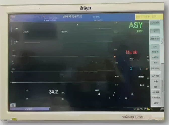 产科全麻病例讨论,妊娠期非产科手术麻醉指南