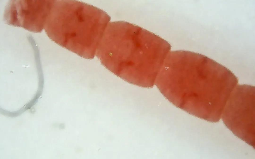 肛拭子有危害吗,肛拭子的好处