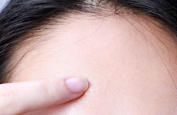 痘坑痘印修复的最佳方法片仔癀,片仔癀抗痘修复贴