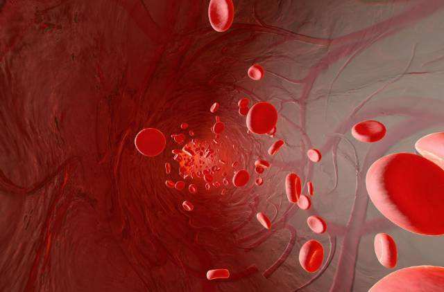 慢性肾衰竭尿毒症保守治疗方案,慢性肾衰竭尿毒症期护理措施是