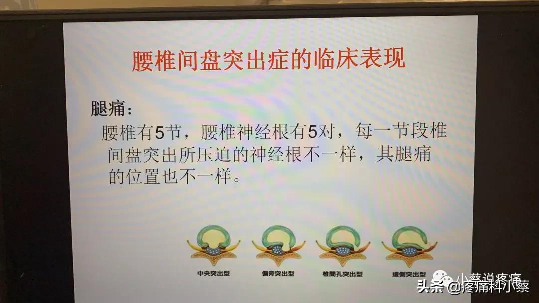 蔡主任讲座视频,蔡主任团队