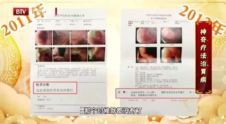 行医59年81岁老中医,一女子胃癌喝中药治好了