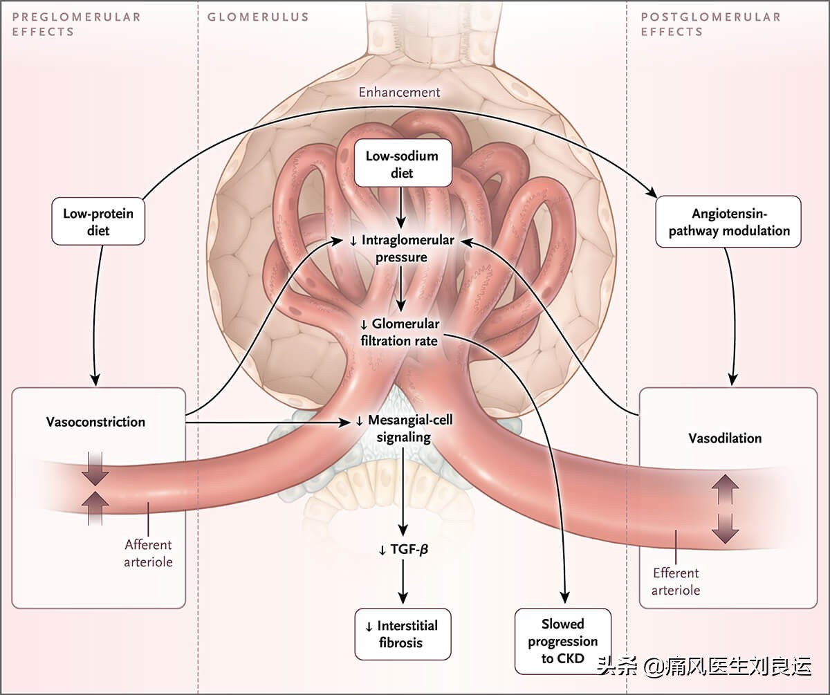莴笋嘌呤高吗痛风可以吃吗,菠菜嘌呤不高为啥痛风不能吃