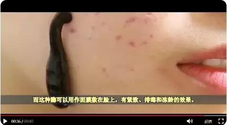 为了祛痘,小伙买10条活蚂蟥放脸上!结果悲剧了……