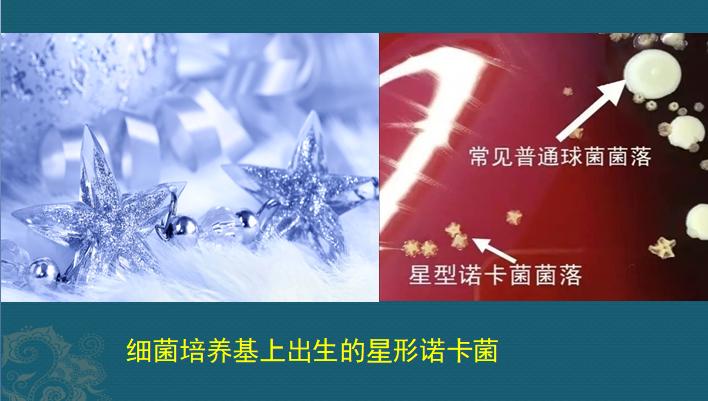 肺诺卡菌感染，当1种分解落叶的细菌，被吸入肺脏