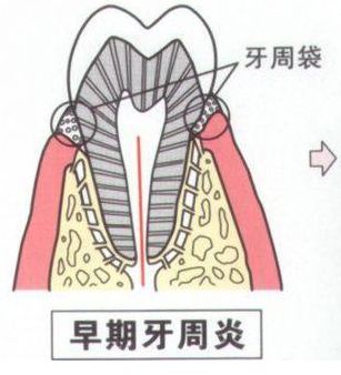 为什么牙总疼还不知道哪颗牙疼,牙疼不确定是哪颗牙能检查出来么