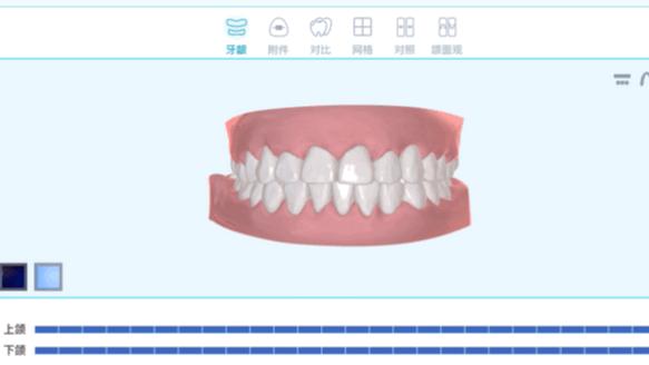 隐形牙套生产运营费用和收入状况,隐形牙套暴利