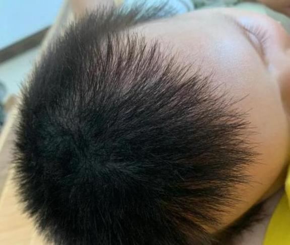 如何改变胎毛生长方向,怎么改变胎毛生长方向