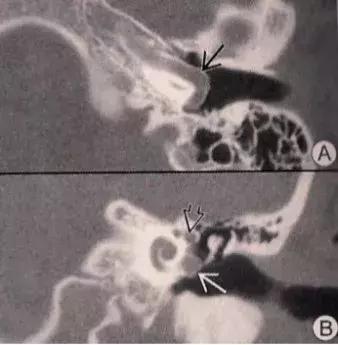 科普如何正确认识耳鸣,科普文的趣味性