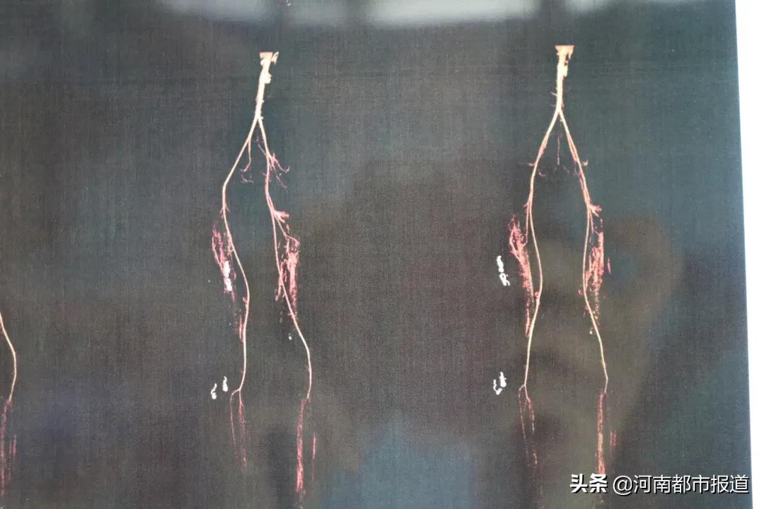 郑大一附院救大象,广西医科大救助小女孩